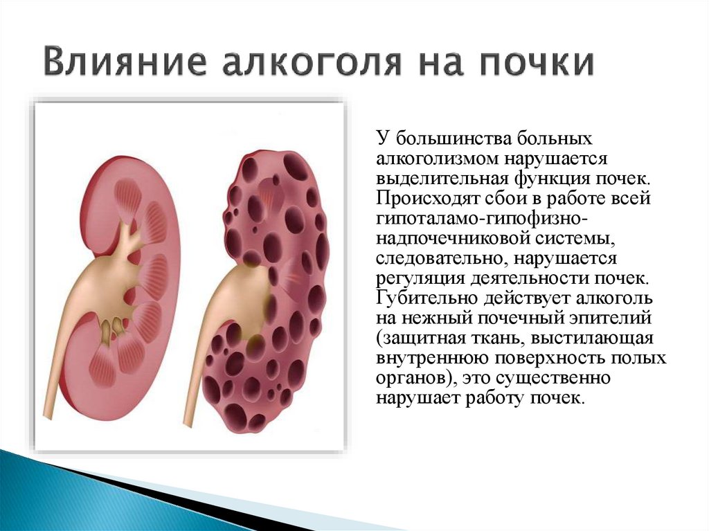 Влияние алкоголя на почки презентация