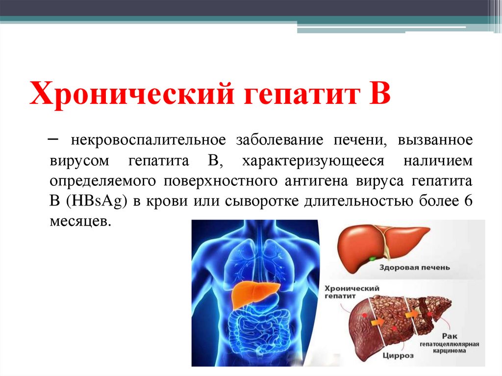 Хронический гепатит В