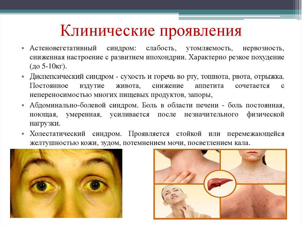 Клинические проявления