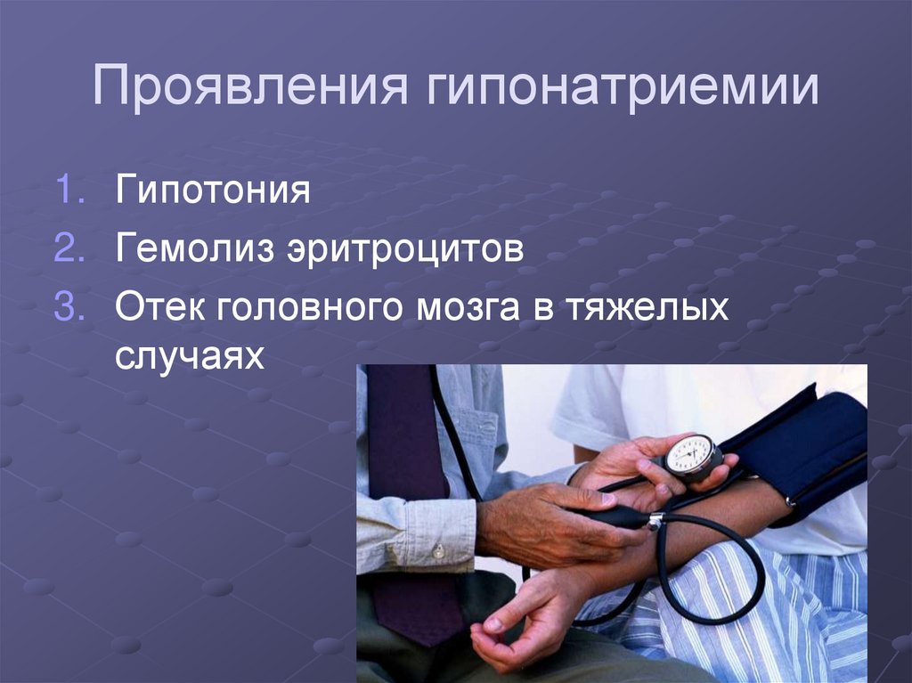 Проявления гипонатриемии