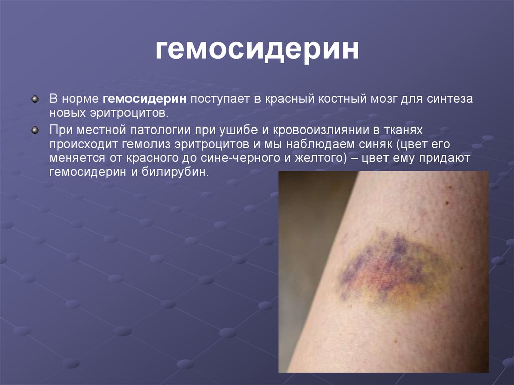 гемосидерин