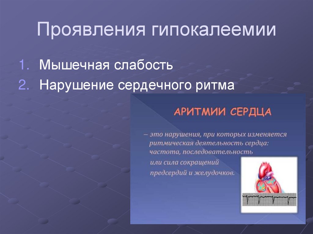 Проявления гипокалеемии