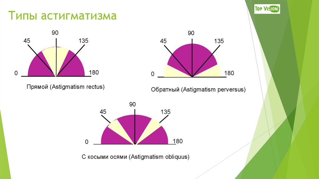 Астигматизм группа здоровья