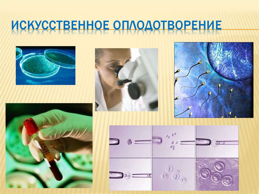 Искусственное оплодотворение