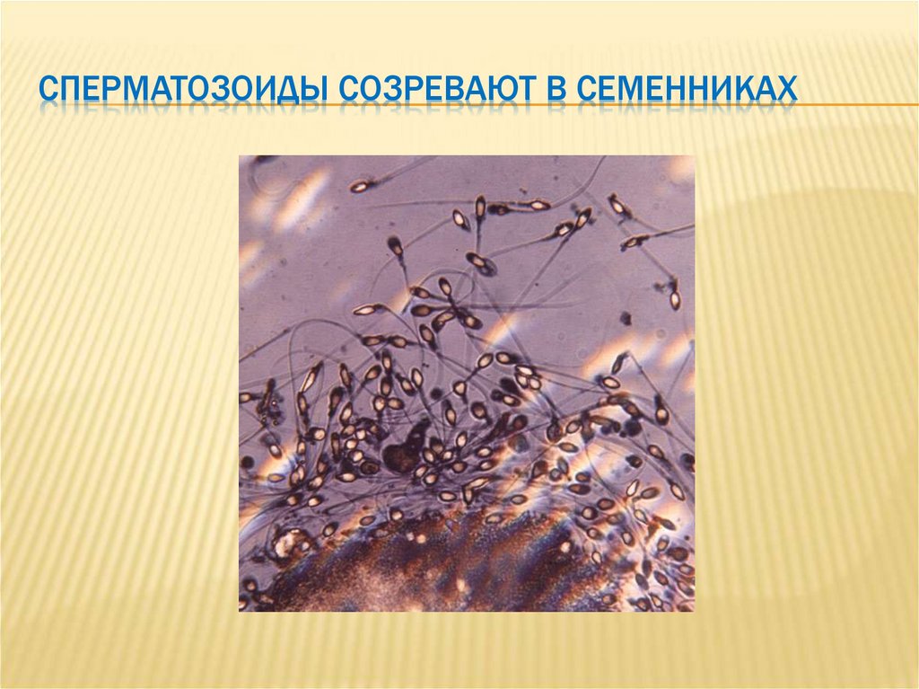 Сперматозоиды созревают в семенниках