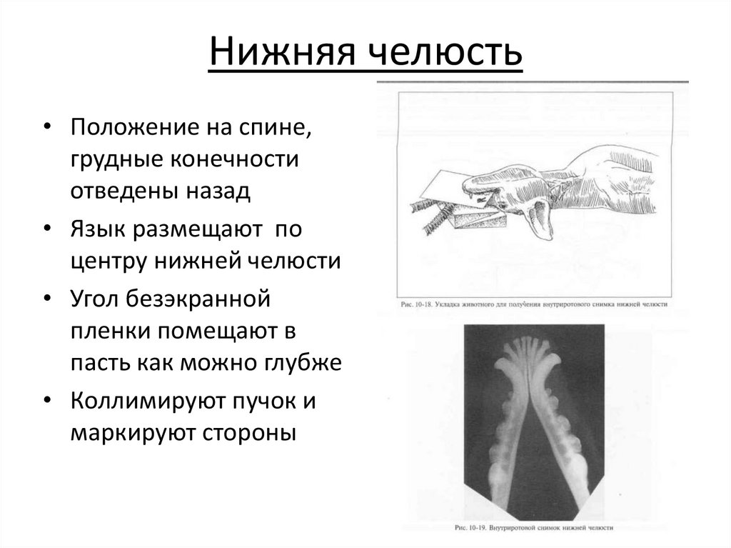 Стандартные укладки при рентгенографическом исследовании - online ...