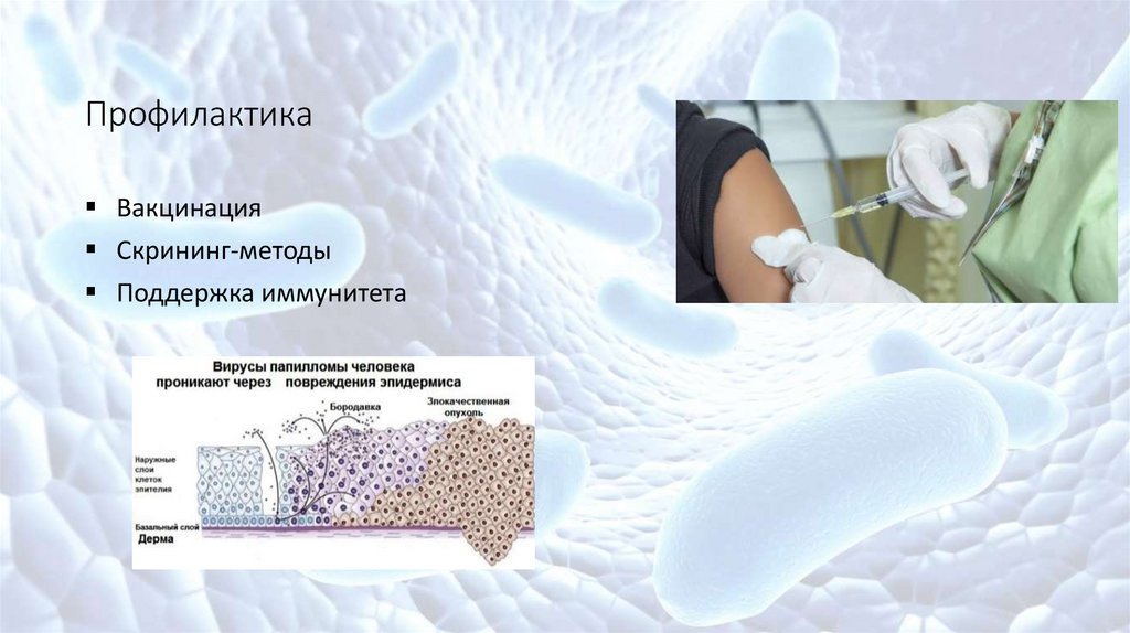 Вирус папилломы человека - online presentation