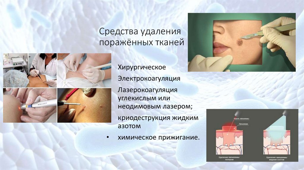 Вирус папилломы человека - презентация онлайн