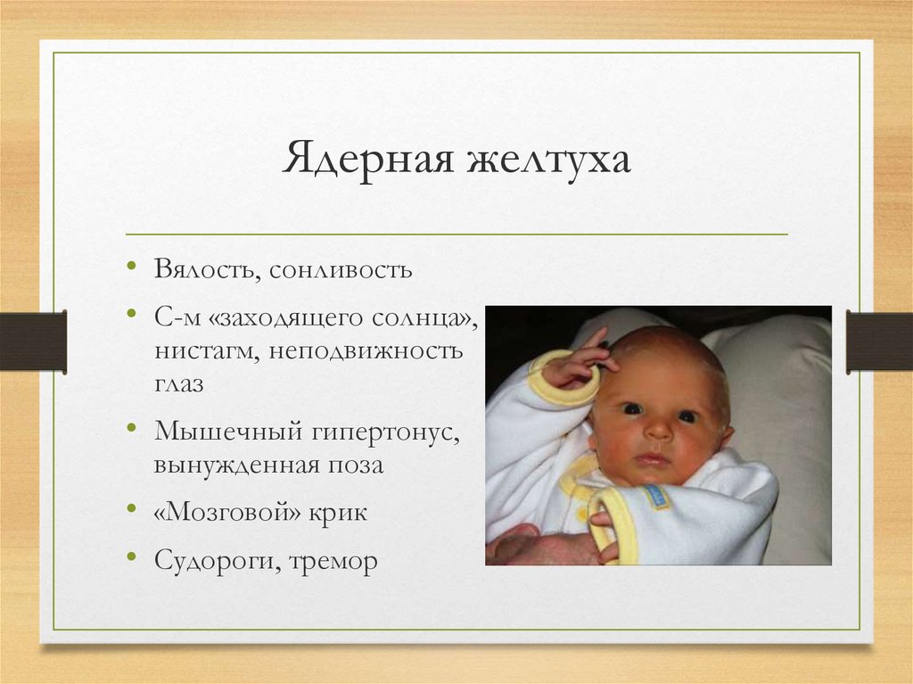 Курсовая работа: Организация специализированного сестринского ухода при желтухах и гемолитической болезни новорож