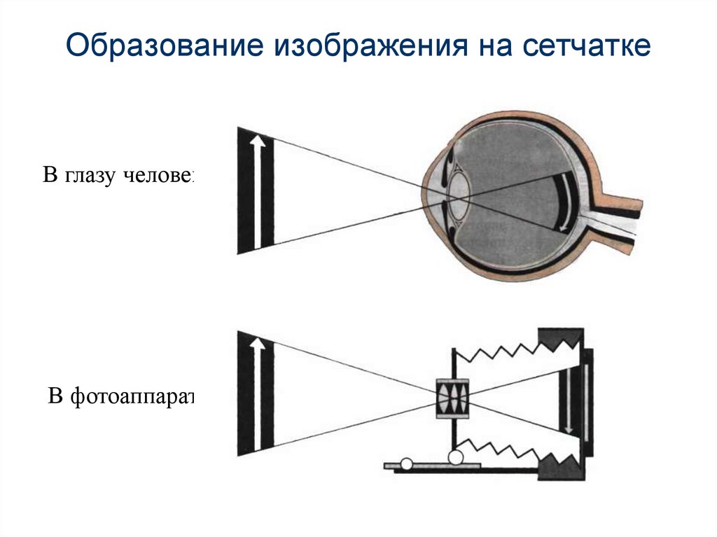 Образование изображения на сетчатке. Какое изображение образуется на сетчатке глаза?. Какое изображение образуется в проекторе. Фокусировка света на сетчатке при разных амметропиях.