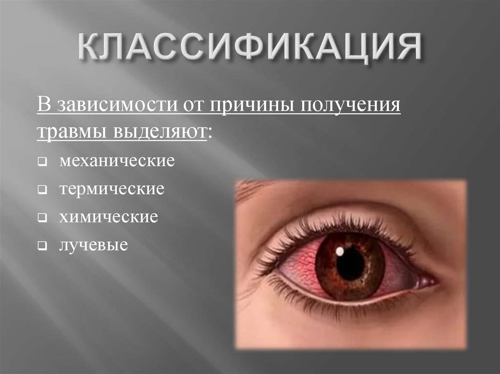 Неврит зрительного нерва - презентация онлайн