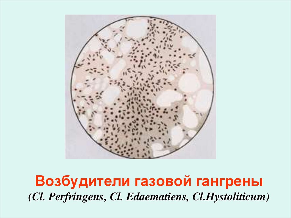 Возбудитель газовой гангрены рисунок