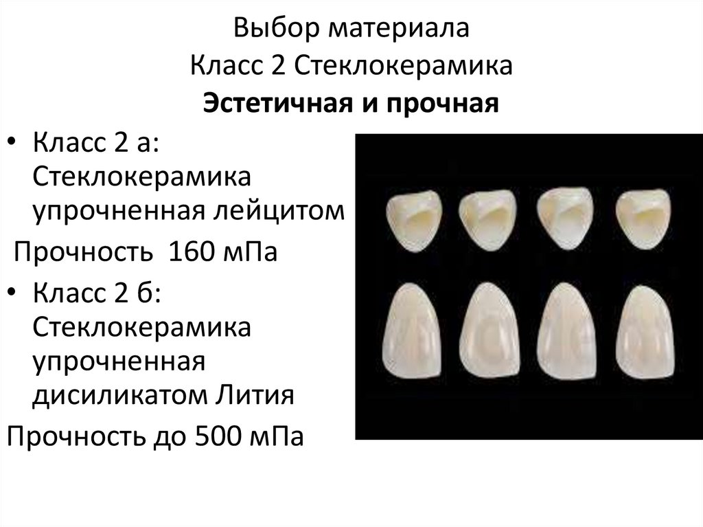 Протокол адгезивной фиксации керамических реставраций презентация