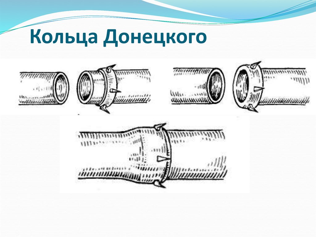 Сосудистый шов история