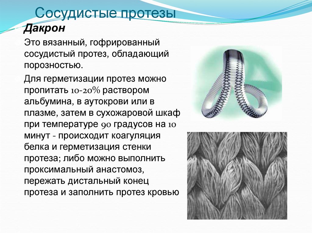 Сосудистые протезы