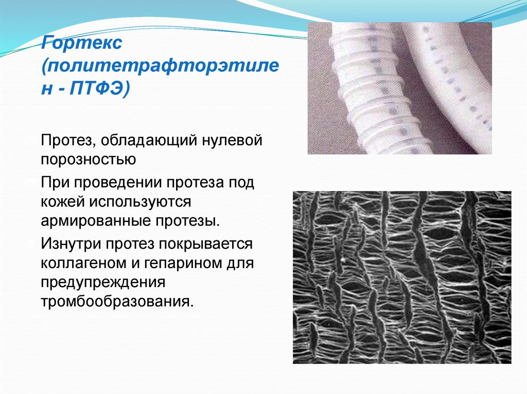 Сосудистый шов - online presentation