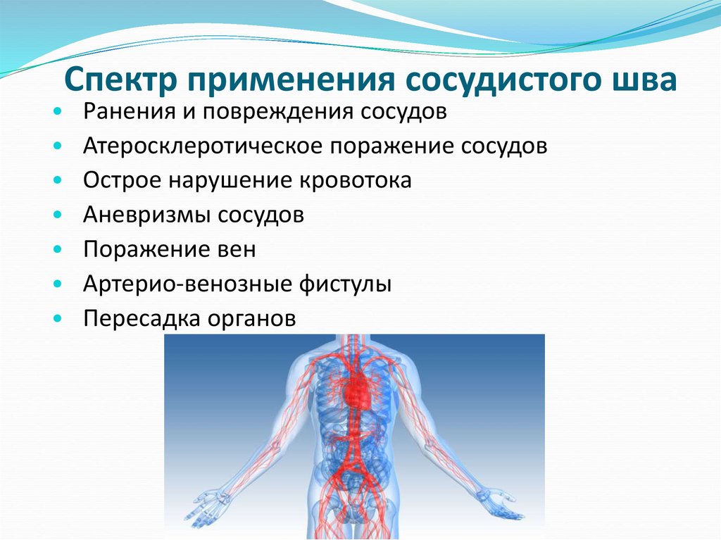Спектр применения сосудистого шва