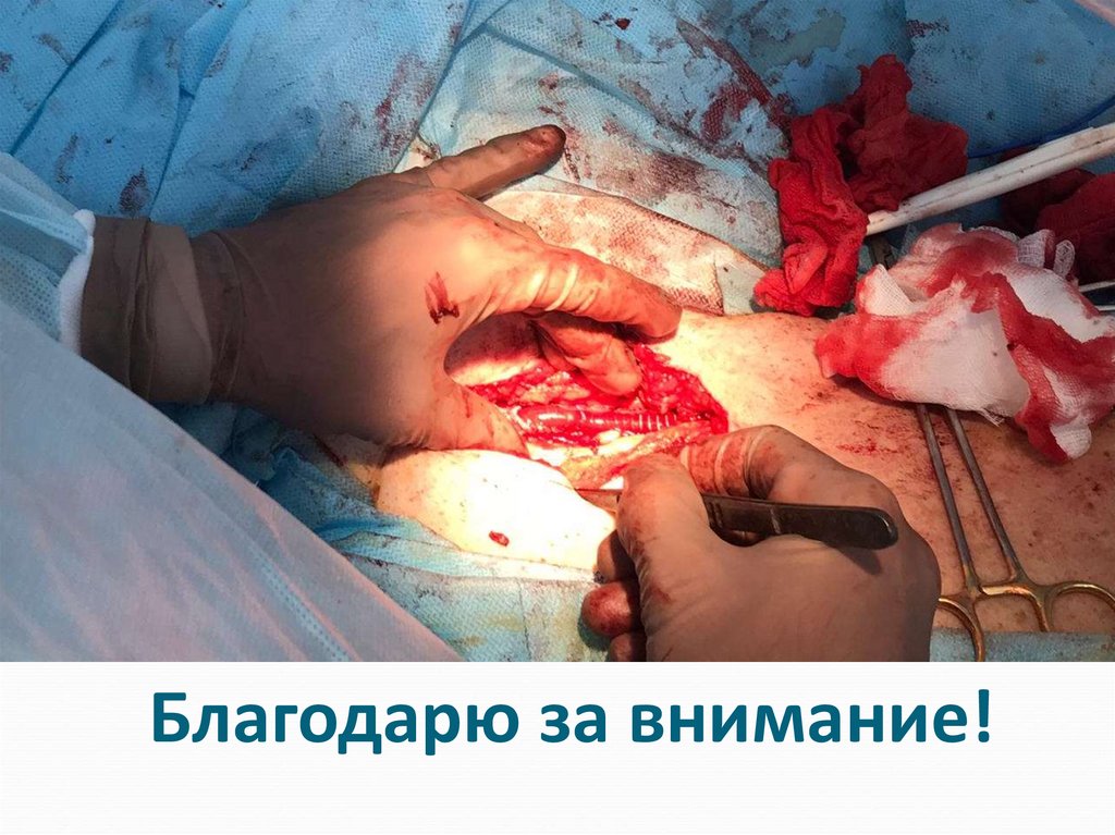 Благодарю за внимание!