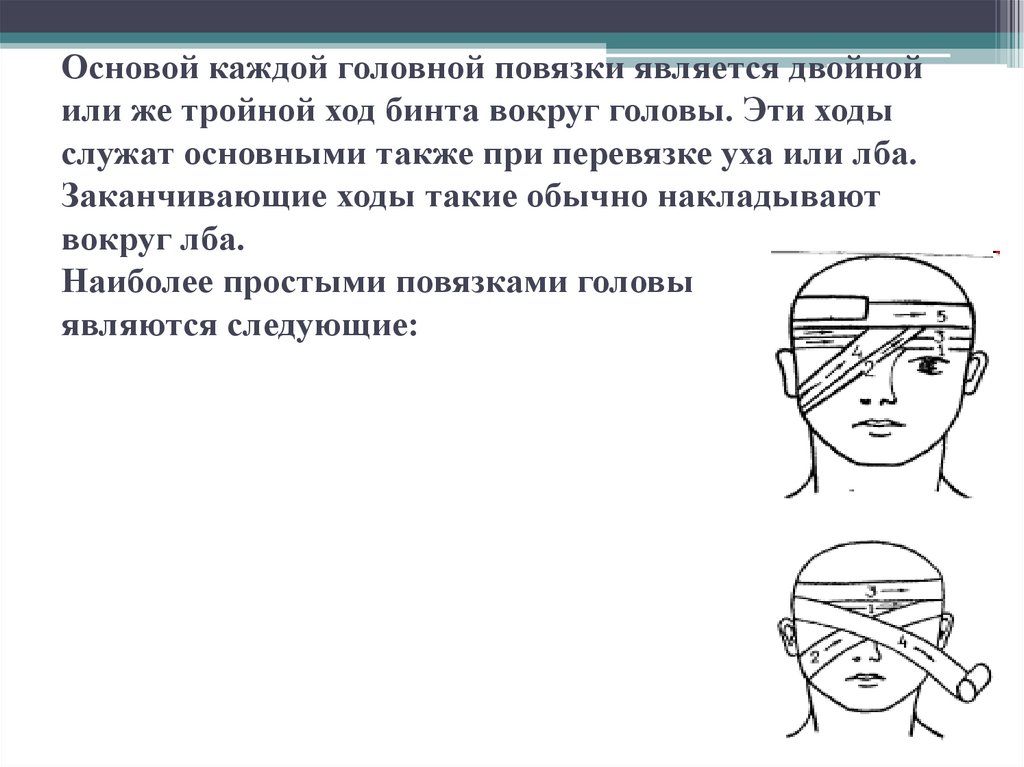 Фиксирующий ход повязки. При ранениях волосистой части головы накладывается повязка. Требования к правильно наложенной повязке. Презентация наложение повязки на глаз. Основные ошибки при наложении повязок.