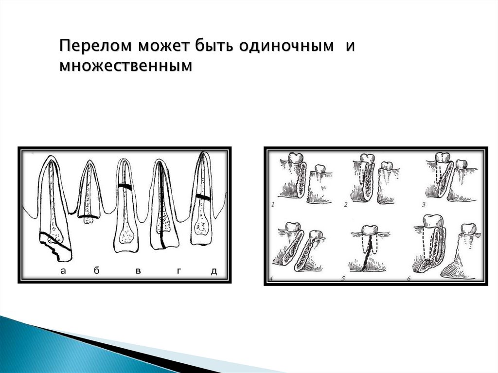 Рентгенологическая картина зубов и их зачатков на различных этапах формирования