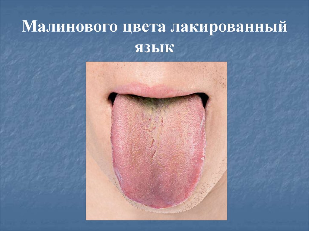 tsirroz_pecheni - презентация онлайн