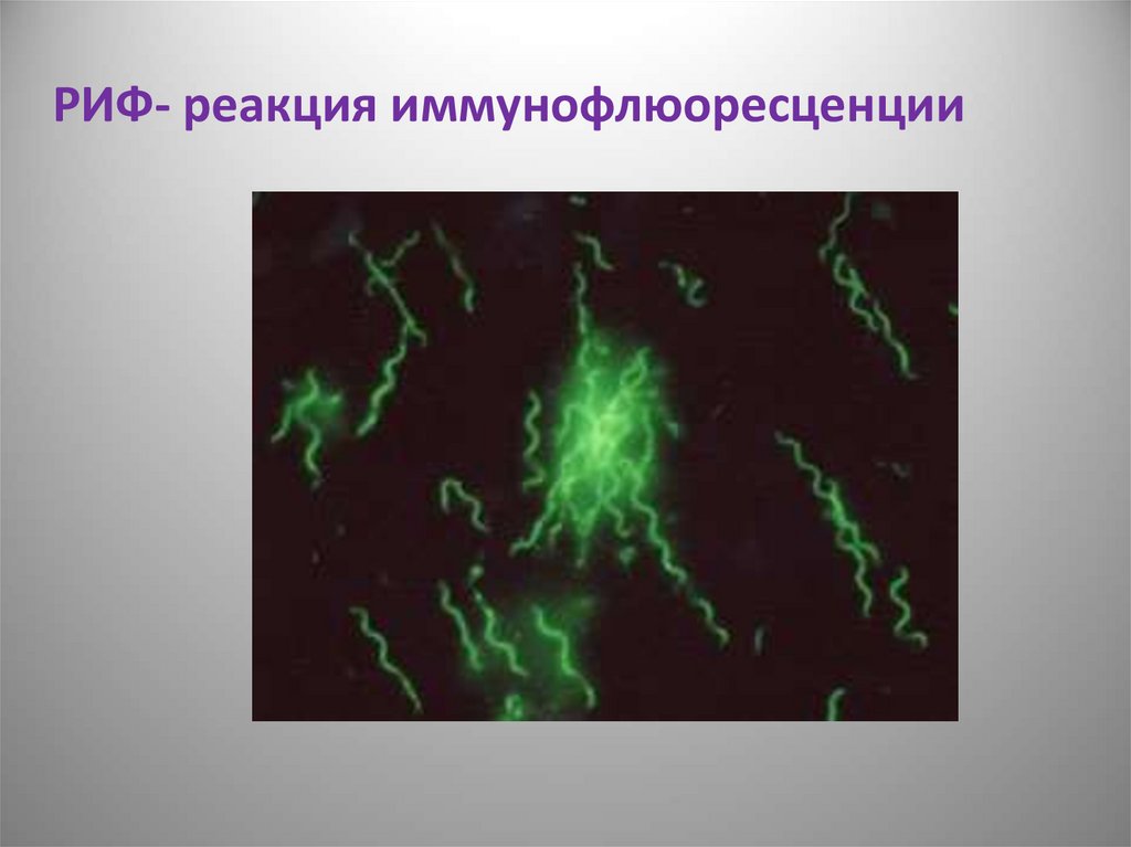 Риф это микробиология. Риф реакция иммунофлюоресценции. Реакция иммунофлуоресценции (риф). Реакция риф микробиология. Иммунофлюоресценция микробиология.