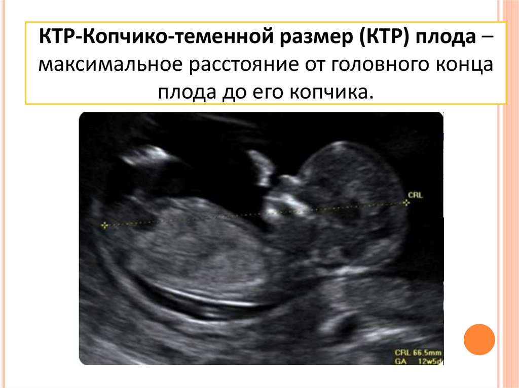 Ктр 13 недель. УЗИ 13 недель беременности параметры плода. УЗИ 12 недель беременности КТР. КТР плода на 12 неделе беременности. УЗИ скрининг КТР.