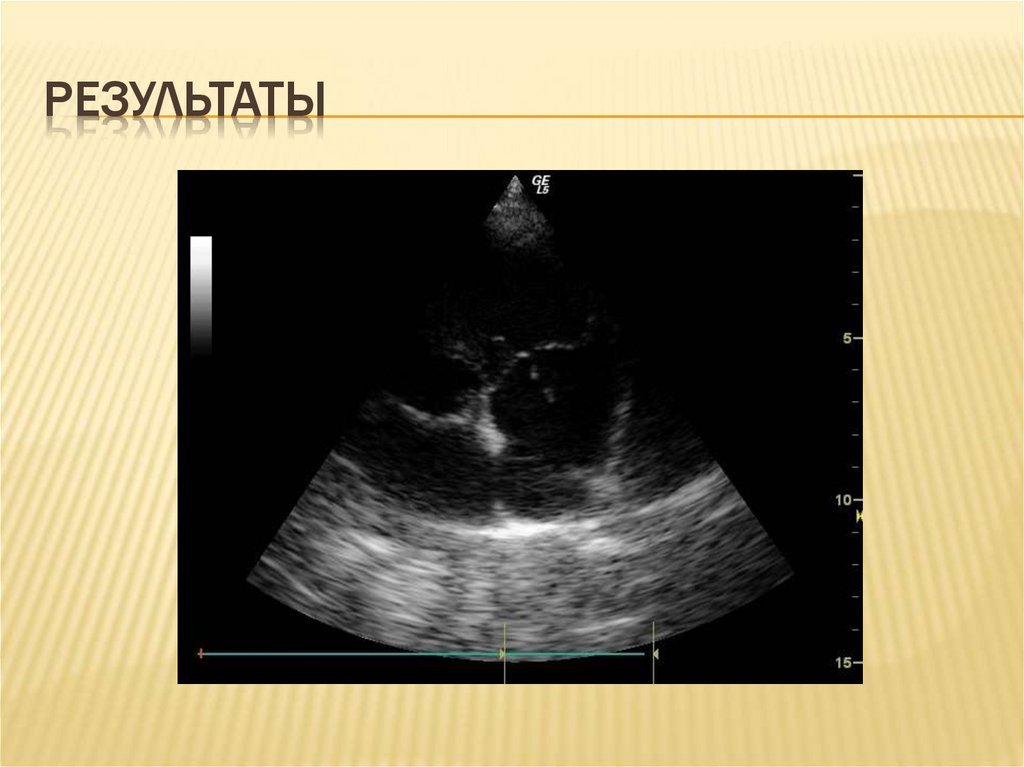 результаты