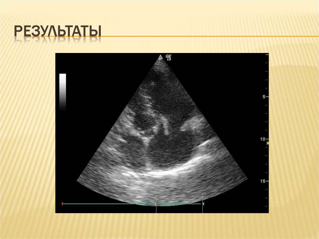 результаты