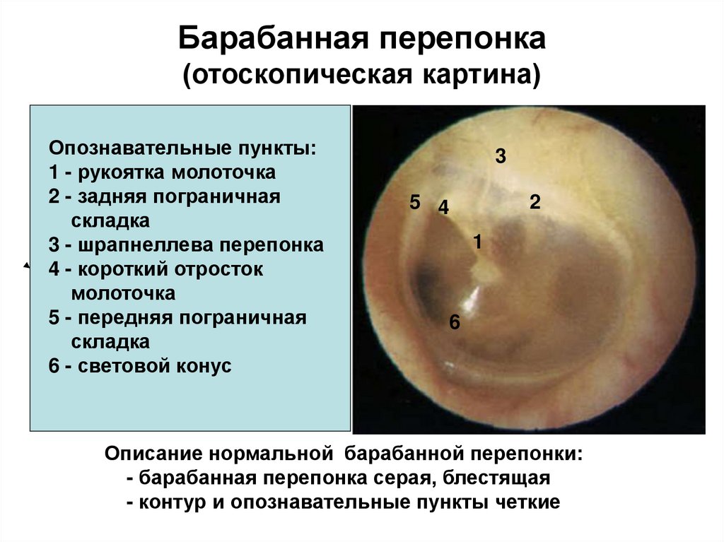 Квадранты барабанной перепонки рисунок