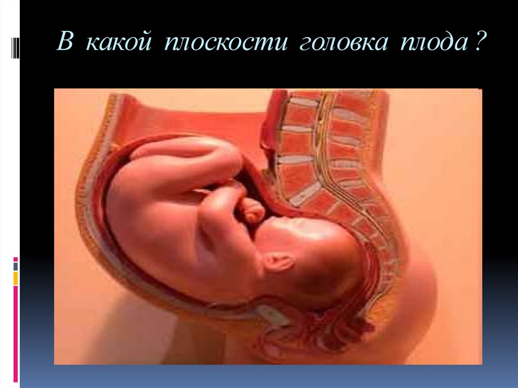 39 недель головка. Расположение ребенка на 32 неделе. Низко расположена головка плода на 32 неделе беременности. Низкое расположение ребенка. Расположение ребенка на 33 неделе.