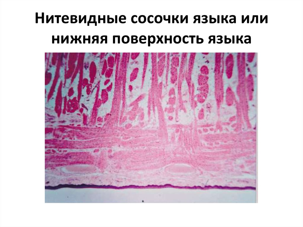 Нитевидные сосочки языка фото