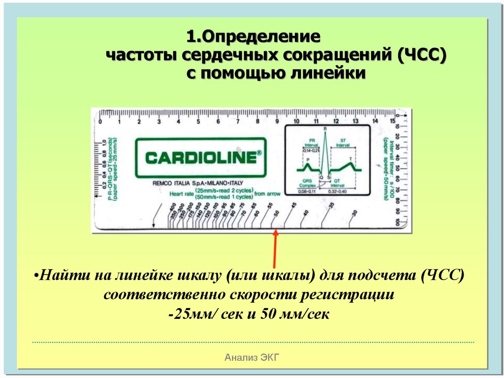 Чсс по экг. Подсчет ЧСС на ЭКГ 25 мм/с. ЧСС по ЭКГ 50 мм/с. Подсчет ЧСС на ЭКГ 50 мм/с. Линейка для измерения ЧСС на ЭКГ.