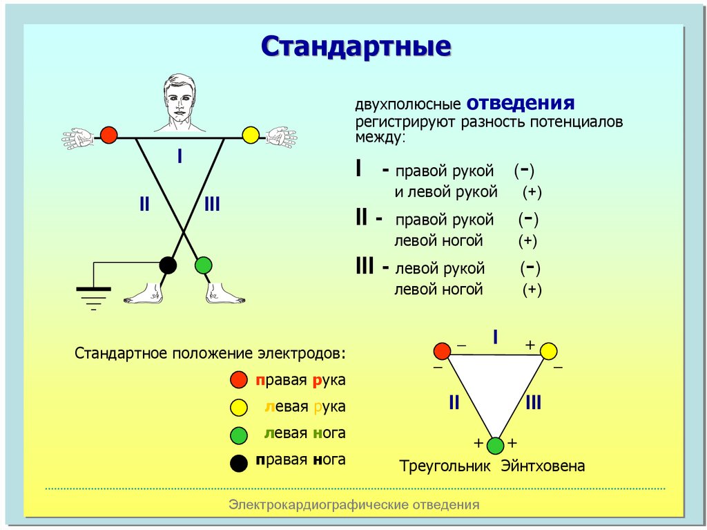 Алгоритм экг. Методика снятия ЭКГ алгоритм. Наложение электродов ЭКГ алгоритм. Наложение электродов при ЭКГ стандартные отведения. Техника снятия ЭКГ.