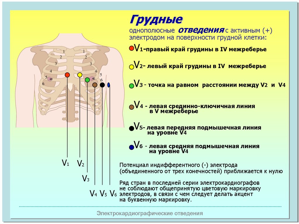 Схема установки экг