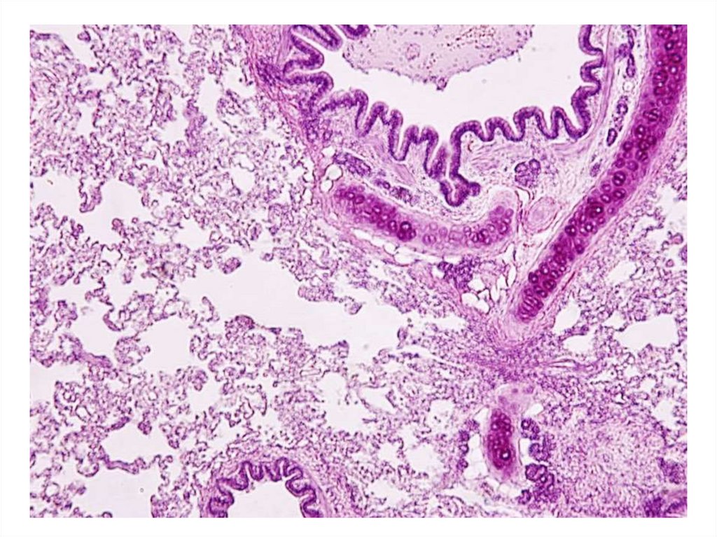 Стенка бронха гистология