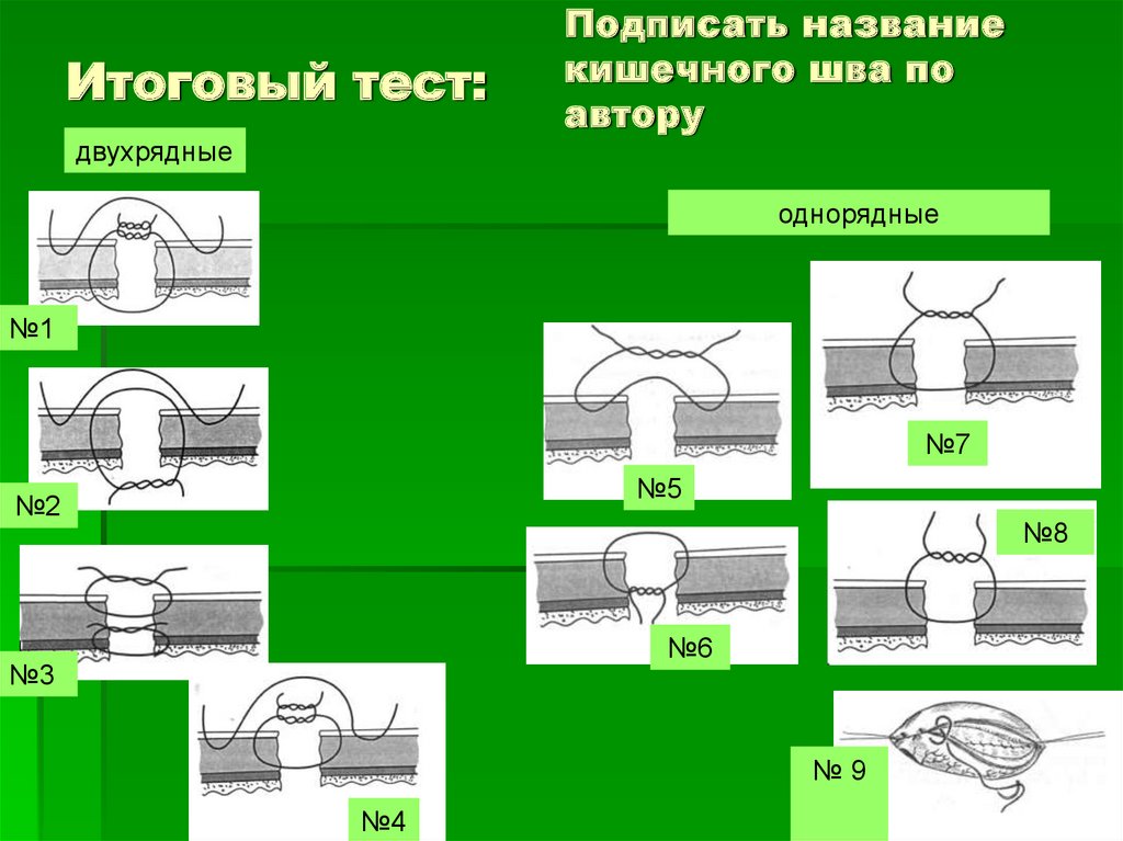 Кишечный шов презентация