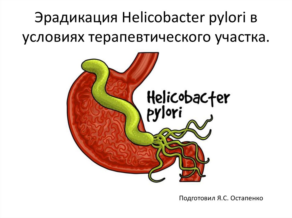Bicarbonato y helicobacter pylori