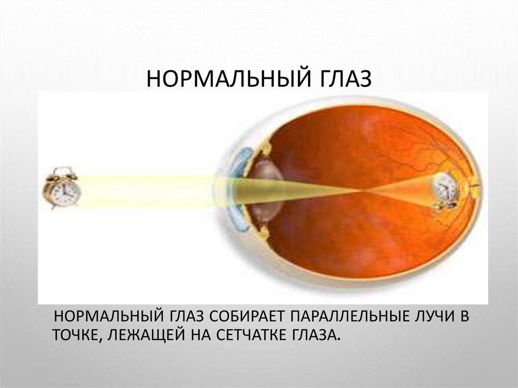 Оптические системы презентация. Глаз как оптическая система. Оптические системы 11 класс.