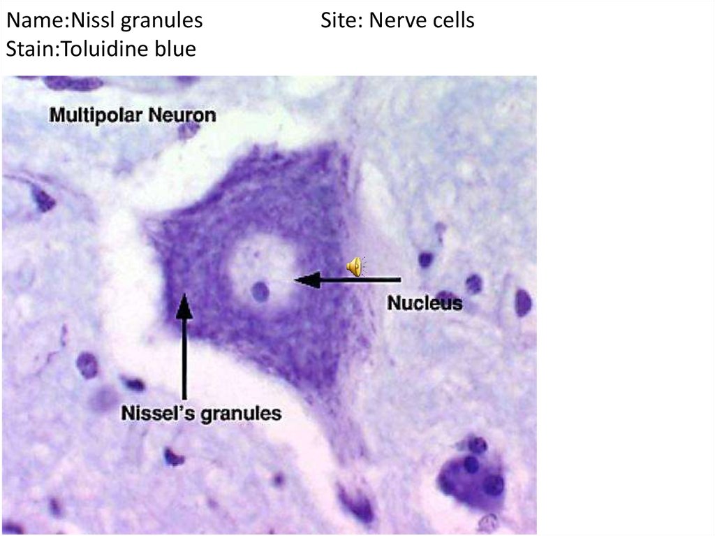 The cell Vesicular nucleus in liver cells - Ð¿Ñ€ÐµÐ·ÐµÐ½Ñ‚Ð°Ñ†Ð¸Ñ  Ð¾Ð½Ð»Ð°Ð¹Ð½