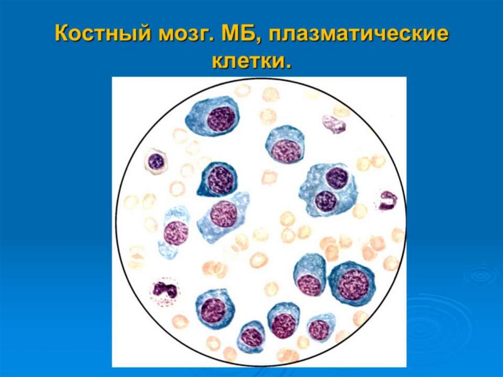 Костный мозг. МБ, плазматические клетки.
