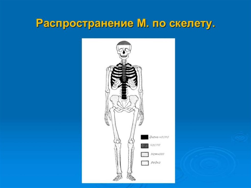 Распространение М. по скелету.