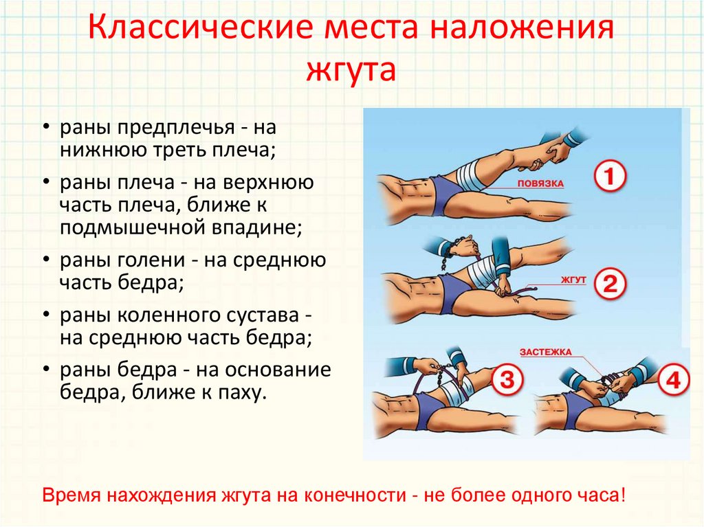 На какое максимальное время кровоостанавливающий жгут