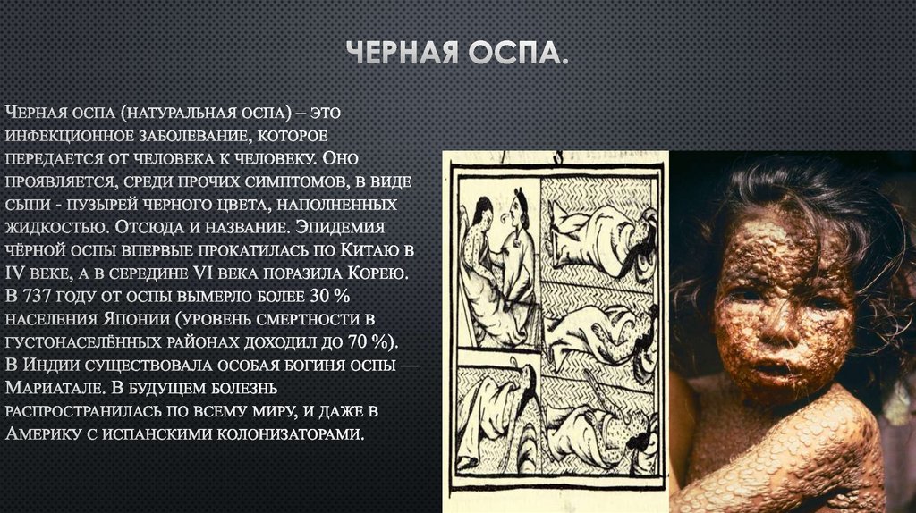 Черная оспа.