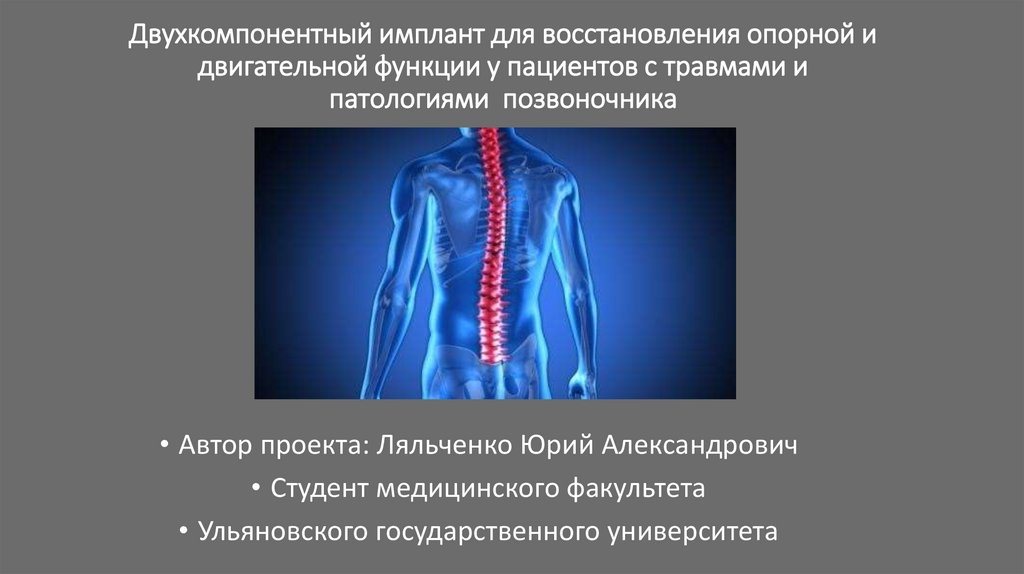 Травма позвоночника картинки