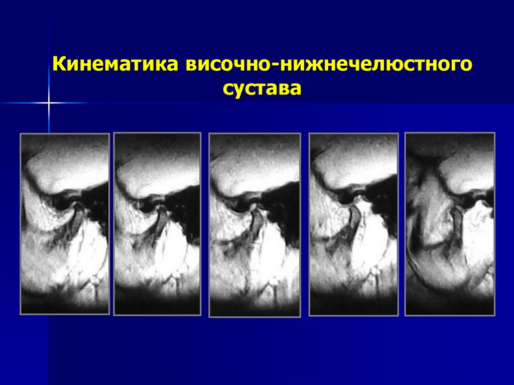 Презентация заболевания внчс