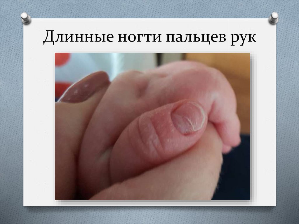 Длинные ногти пальцев рук