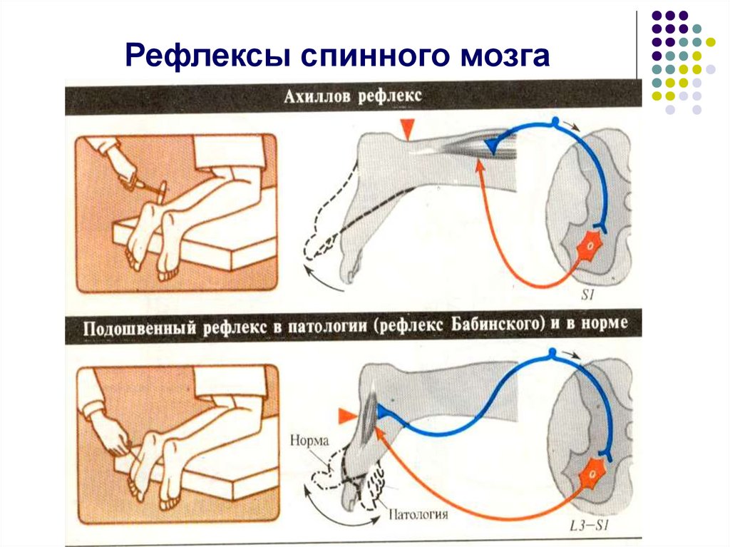 Схема рефлексов спинного мозга