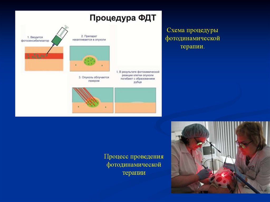 Фотодинамическая диагностика основы и принцип метода презентация