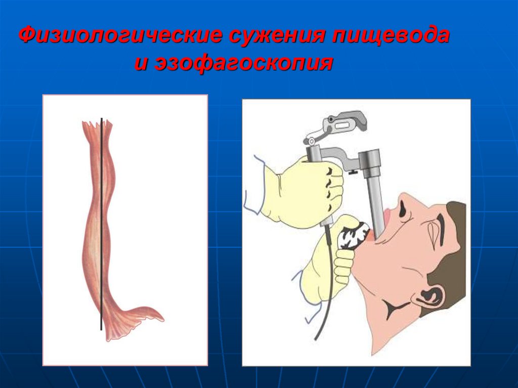 Рисунок трахеи и пищевода